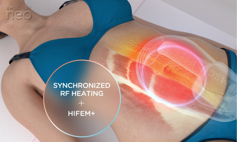 Emsculpt Neo® in  Harrisonburg, VA 